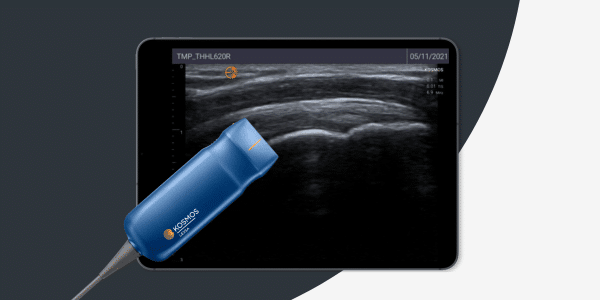 KOSMOS med LEXSA transducer - Håndholdt ultralydsscanner til MSK scanning