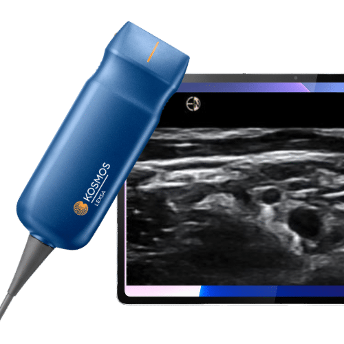 Håndholdt ultralydsscanner til en god pris