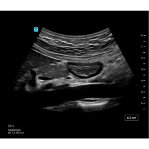 kliniske billeder af høj kvalitet med Sonosite ST ultralydsscanner 