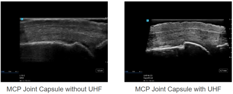 Ultra høj frekvens scanningsfoto