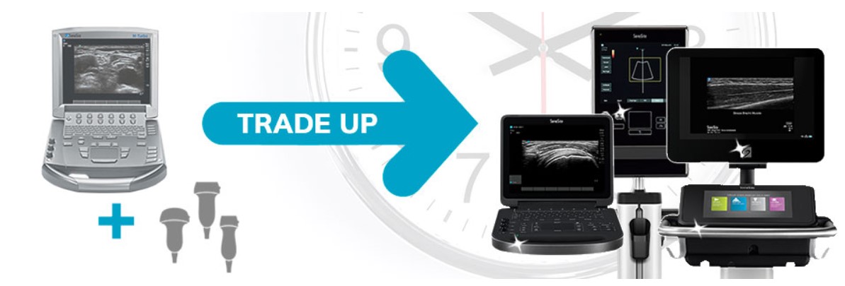 5 redenen om te upgraden naar een nieuw SonoSite toestel