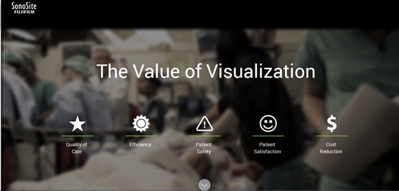 The Value of Visualization