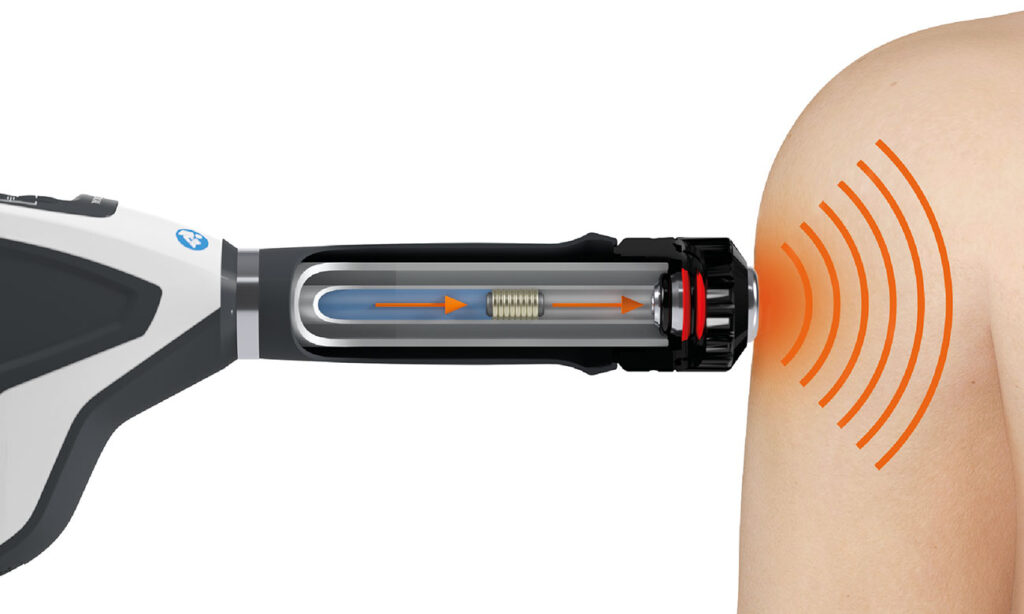 Shockwave Terapi forklaret