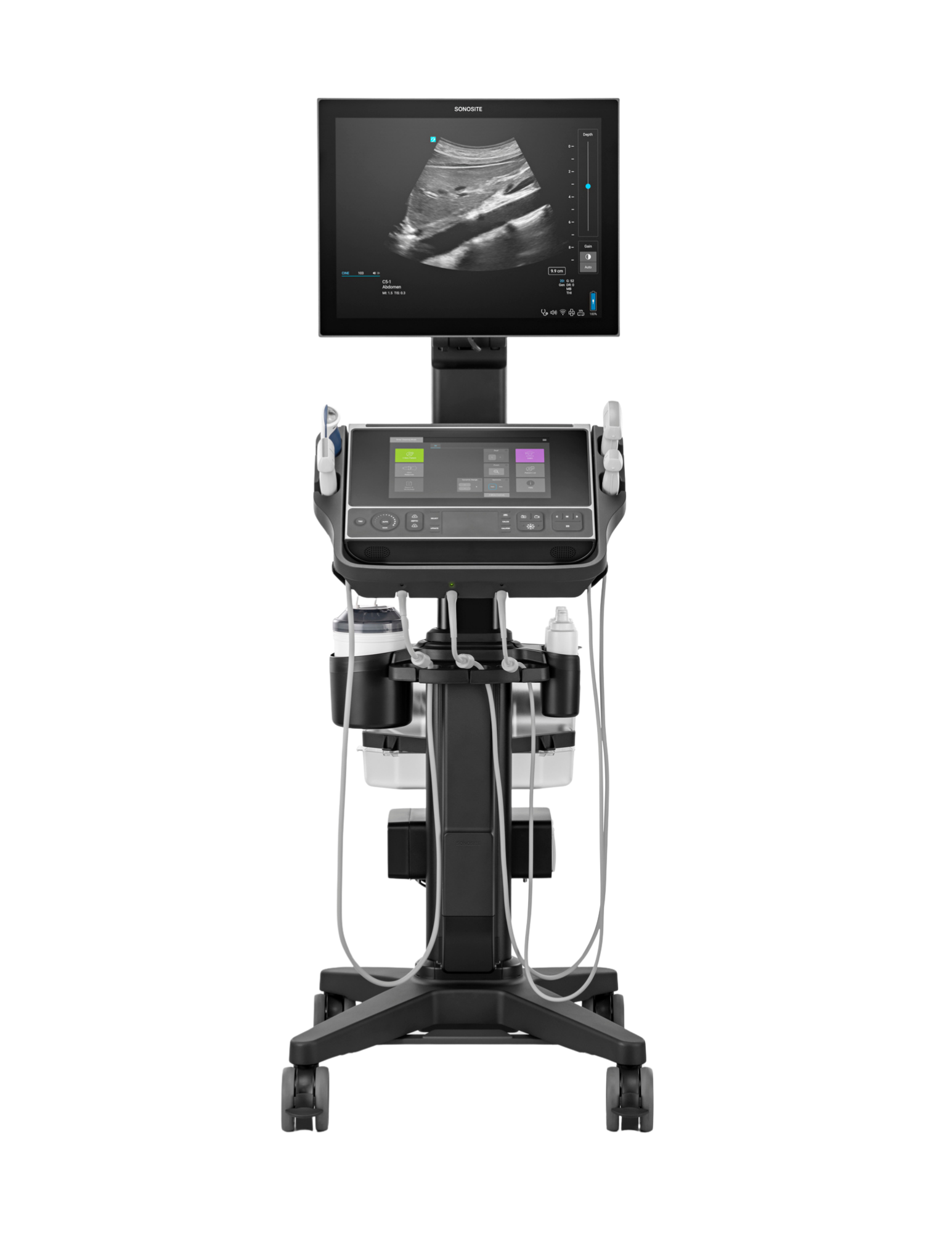 Ultralydsscanner Sonosite LX Secma