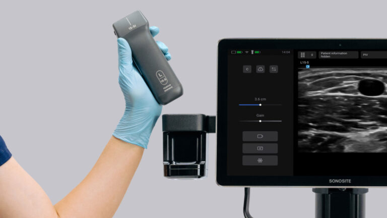 Sonosite iLOOK-L15-5-in-charging-doc-with-L15-5-PIV-Cephalic-V-TRV-