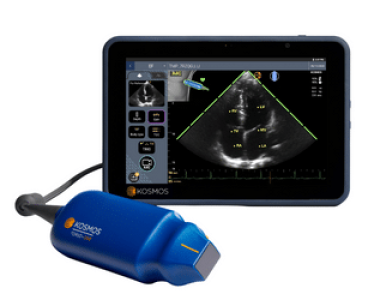 Kosmos håndholdt ultralydsscanner fra Secma